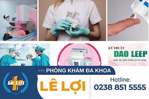 Phuong-phap-chua-benh-phu-khoa (2)